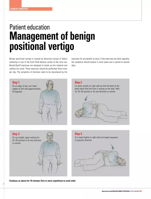 Patient education - Management of benign positional vertigo - RACGP