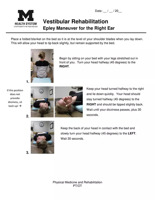 Epley Maneuver for the Right Ear - Vestibular Rehabilitation