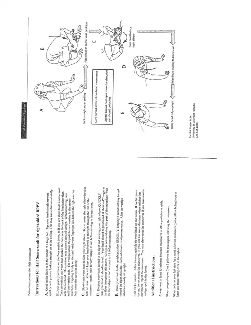 other-benign-positional-vertigo-exercises.pdf - Burson ENT